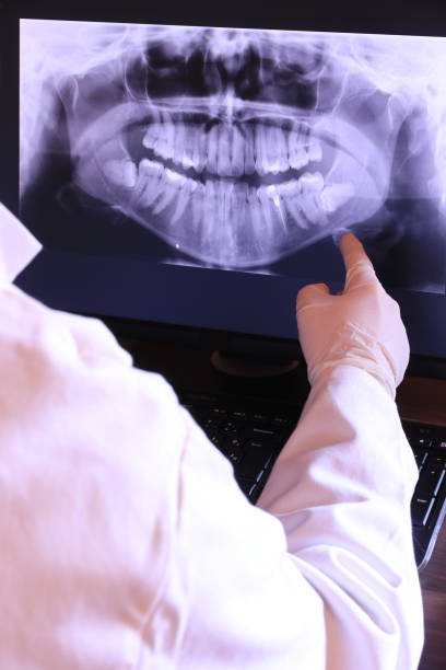 Best Emergency Dental Care for Broken or Chipped Teeth in Stanleytown, VA